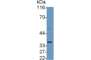 Detection of IL2Ra in Porcine Lymph node lysate using Polyclonal Antibody to Interleukin 2 Receptor Alpha (IL2Ra) (CD25 antibody  (AA 22-236))