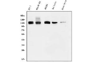 Western blot analysis of KIBRA/WWC1 using anti-KIBRA/WWC1 antibody (ABIN7602724). (WWC1 antibody  (AA 990-1080))