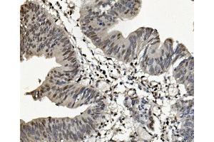 IHC analysis of SAMHD1 using anti-SAMHD1 antibody (ABIN7601516). (SAMHD1 antibody  (AA 37-626))