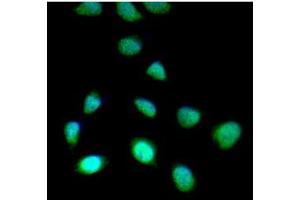 ICC/IF analysis of SET7/9 in HeLa cells line, stained with DAPI (Blue) for nucleus staining and monoclonal anti-human SET7/9 antibody (1:100) with goat anti-mouse IgG-Alexa fluor 488 conjugate (Green). (SET7/9 antibody)
