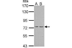 WB Image Sample (30 ug of whole cell lysate) A: NIH-3T3 B: JC 7. (PRKG1 antibody  (Center))