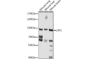 Western blot analysis of extracts of various cell lines, using LRP1 Rabbit pAb (ABIN6130085, ABIN6143323, ABIN6143324 and ABIN6217535) at 1:1000 dilution.