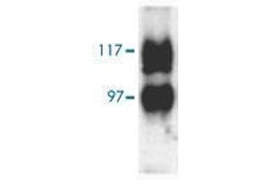 Western blot analysis of Slc14a2 in rat kidney (inner medulla) with Slc14a2 polyclonal antibody  at 1:1000 dilution. (Solute Carrier Family 14 (Urea Transporter, Kidney) Member 2 (SLC14A2) (AA 911-929) antibody)