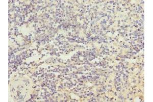 Immunohistochemistry of paraffin-embedded human spleen tissue using ABIN7156852 at dilution of 1:100 (IL21 Receptor antibody  (AA 20-240))