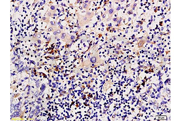 Cytokeratin 1 antibody  (AA 141-240)