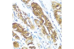 Immunohistochemistry of paraffin-embedded human stomach using NME3 antibody (ABIN3016659, ABIN3016660, ABIN3016661 and ABIN6219806) at dilution of 1:100 (40x lens). (NME3 antibody  (AA 20-169))