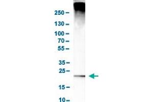 Western Blot analysis of human cell line MCF-7.