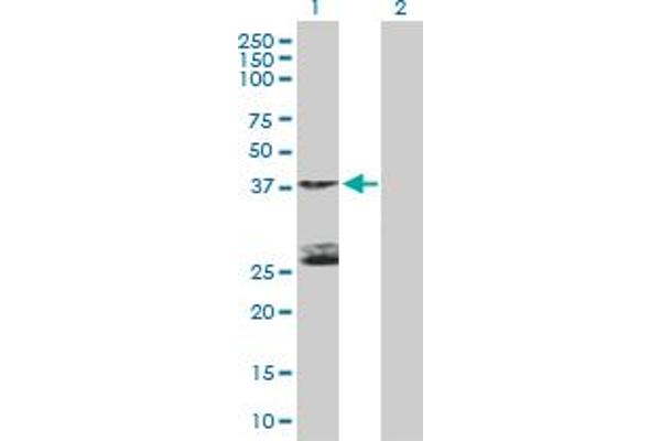 STK19 anticorps  (AA 1-364)