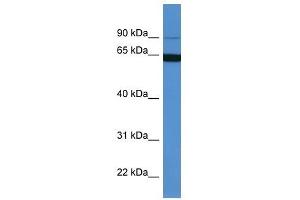 Western Blot showing MAP6 antibody used at a concentration of 1-2 ug/ml to detect its target protein. (MAP6 antibody  (N-Term))