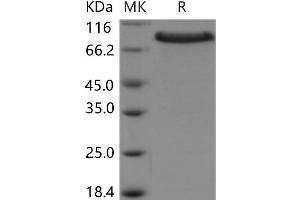 Western Blotting (WB) image for Cysteine-Rich with EGF-Like Domains 1 (CRELD1) protein (Fc Tag,ECD) (ABIN7195349) (CRELD1 Protein (Fc Tag,ECD))