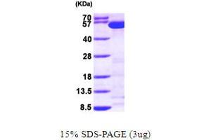 SDS-PAGE (SDS) image for Tryptophanyl-tRNA Synthetase (WARS) (AA 1-471) protein (His tag) (ABIN667149)