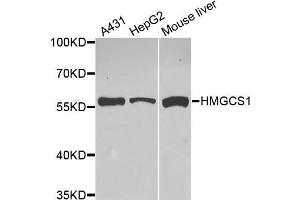Western Blotting (WB) image for anti-3-Hydroxy-3-Methylglutaryl-CoA Synthase 1 (Soluble) (HMGCS1) (AA 241-520) antibody (ABIN1680300) (HMGCS1 antibody  (AA 241-520))