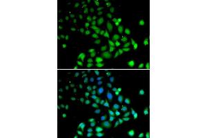 Immunofluorescence analysis of U2OS cells using PARN antibody (ABIN5972174). (PARN antibody)