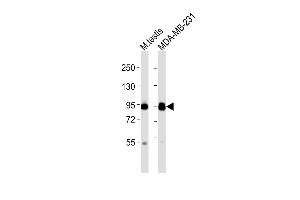 EZH2 antibody  (N-Term)