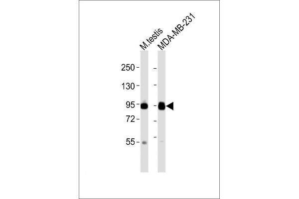 EZH2 antibody  (N-Term)