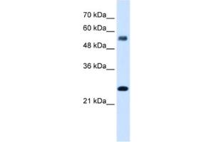 Western Blotting (WB) image for anti-SMAD, Mothers Against DPP Homolog 1 (SMAD1) antibody (ABIN2461768) (SMAD1 antibody)