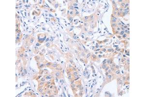 Immunohistochemistry (IHC) image for anti-Cell Division Cycle Associated 4 (CDCA4) antibody (ABIN2434444)