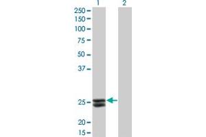 Western Blot analysis of PRL expression in transfected 293T cell line by PRL monoclonal antibody (M02), clone 1E1. (Prolactin antibody  (AA 29-227))