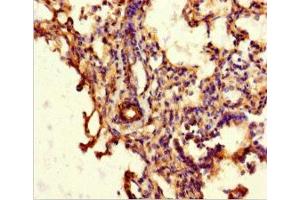 Immunohistochemistry of paraffin-embedded human lung tissue using ABIN7144942 at dilution of 1:100 (ABCG8 antibody  (AA 176-413))