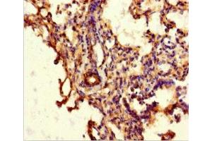 Immunohistochemistry of paraffin-embedded human lung tissue using ABIN7144942 at dilution of 1:100