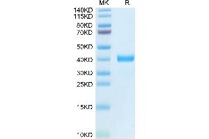 Human MFAP4 on Tris-Bis PAGE under reduced condition. (MFAP4 Protein (AA 22-255) (His-DYKDDDDK Tag))