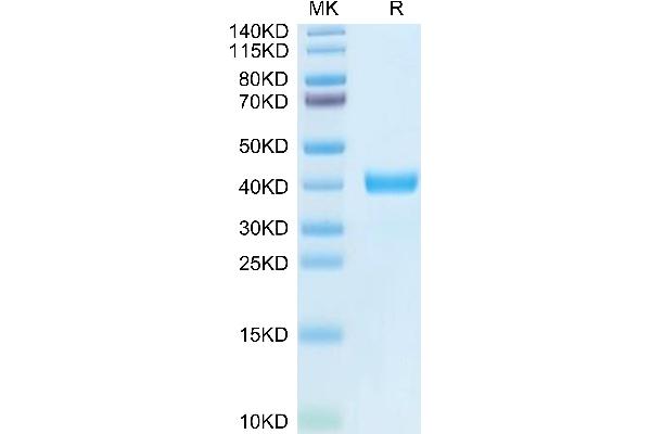 MFAP4 Protein (AA 22-255) (His-DYKDDDDK Tag)