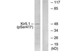 Western blot analysis of extracts from RAW264. (KIR5.1 antibody  (pSer417))