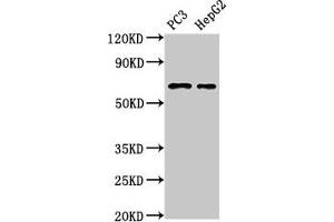 Western Blot Positive WB detected in: PC-3 whole cell lysate, HepG2 whole cell lysate All lanes: PARP2 antibody at 3 μg/mL Secondary Goat polyclonal to rabbit IgG at 1/50000 dilution Predicted band size: 67, 65 kDa Observed band size: 67 kDa (PARP2 antibody  (AA 14-149))