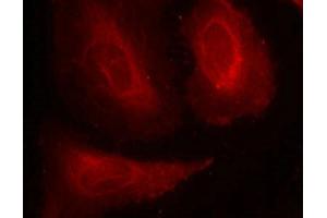 Immunofluorescence staining of methanol-fixed Hela cells using PDK1(Phospho-Ser241) Antibody. (PDPK1 antibody  (pSer241))