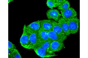 HepG2 cells were fixed with paraformaldehyde, permeabilized with 0. (Peroxiredoxin 1 antibody)