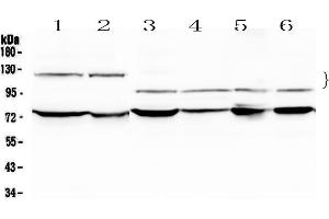 Western blot analysis of NFATC4 using anti-NFATC4 antibody . (NFATC4 antibody  (AA 413-522))