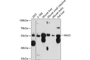 Western blot analysis of extracts of various cell lines, using NAGS antibody (ABIN6130570, ABIN6144346, ABIN6144347 and ABIN6215659) at 1:3000 dilution. (NAGS antibody  (AA 295-534))