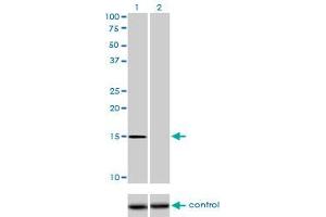 Western blot analysis of NXT1 over-expressed 293 cell line, cotransfected with NXT1 Validated Chimera RNAi (Lane 2) or non-transfected control (Lane 1). (NXT1 antibody  (AA 1-140))