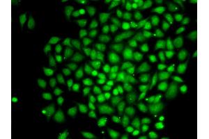 Immunofluorescence analysis of MCF-7 cells using CTCFL antibody (ABIN5973625).