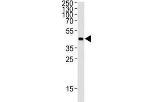 Western blot analysis of lysate from 12 tag recombinant protein (41 kDa) using GST Tag antibody at 1:1000.