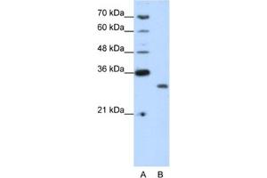 Western Blotting (WB) image for anti-CPX Chromosome Region, Candidate 1 (CPXCR1) antibody (ABIN2461963) (CPXCR1 antibody)