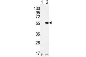 Western blot analysis of PRMT2 antibody and 293 cell lysate either nontransfected (Lane 1) or transiently transfected (2) with the PRMT2 gene. (PRMT2 antibody  (AA 344-375))
