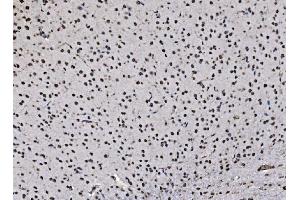 IHC analysis of DBC-1/CCAR2 using anti-DBC-1/CCAR2 antibody (ABIN7602235). (CCAR2 antibody  (AA 65-917))