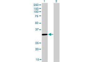 Western Blot analysis of ZNF346 expression in transfected 293T cell line by ZNF346 monoclonal antibody (M01), clone 2D10. (ZNF346 antibody  (AA 133-232))