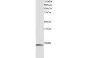 Image no. 1 for anti-Heat Shock 22kDa Protein 8 (HSPB8) (AA 184-196) antibody (ABIN292049) (HSPB8 antibody  (AA 184-196))