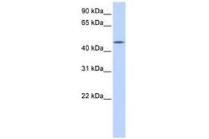 Image no. 1 for anti-Chromosome 20 Open Reading Frame 160 (C20orf160) (AA 71-120) antibody (ABIN6741141) (C20orf160 antibody  (AA 71-120))