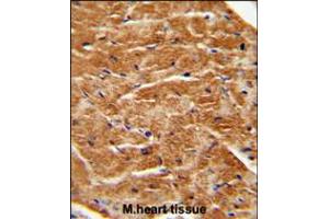 FGF7 antibody immunohistochemistry analysis in formalin fixed and paraffin embedded human M.