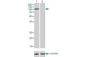 Western blot analysis of PCAF over-expressed 293 cell line, cotransfected with PCAF Validated Chimera RNAi (Lane 2) or non-transfected control (Lane 1). (KAT2B antibody  (AA 353-452))