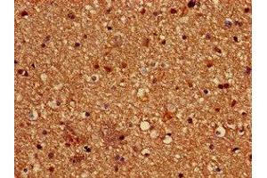 Immunohistochemistry of paraffin-embedded human brain tissue using ABIN7162619 at dilution of 1:100