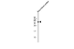 Anti-FAT4 Antibody at 1:2000 dilution + Recombinant protein at 20 ng per lane. (FAT4 antibody  (AA 4500-4786))