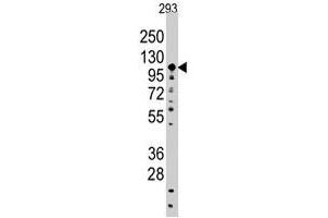 Western blot analysis of SALL4 polyclonal antibody  in 293 cell line lysates (35 ug/lane). (SALL4 antibody  (C-Term))