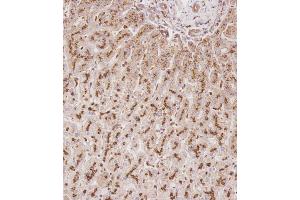 Immunohistochemical analysis of C on paraffin-embedded Human liver tissue. (Glucuronidase beta antibody  (AA 335-362))