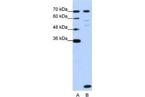 Western Blotting (WB) image for anti-LSM2 Homolog, U6 Small Nuclear RNA Associated (LSM2) antibody (ABIN2462291)