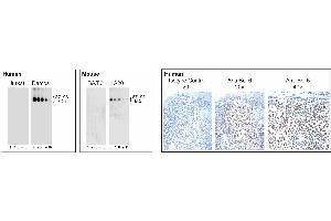 Analysis of Bcl-6 expression by Western blot and Immunohistochemistry. (BCL6 antibody)