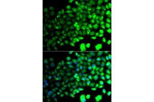 Immunofluorescence analysis of A549 cell using PRKAA2 antibody. (PRKAA2 antibody)